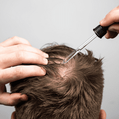 Scandinavian Biolabs Bio-Pilixin Activation Serum pro zpomalení vypadávání a podporu růstu vlasů pro muže 100 ml