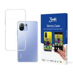 3MK Skinny pouzdro pro Xiaomi Mi 11 Lite 5G/Mi 11 Lite 4G/Mi 11 Lite 5G NE - Transparentní KP20186